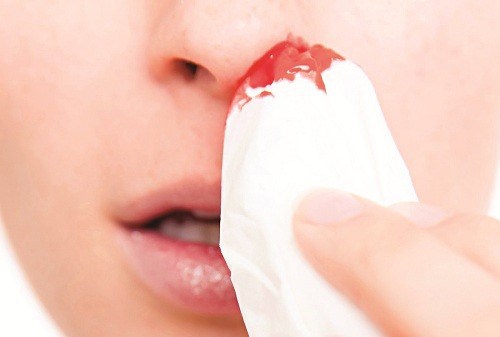 Abnormal Bleeding and Cancer: When Bleeding Becomes a Red Flag