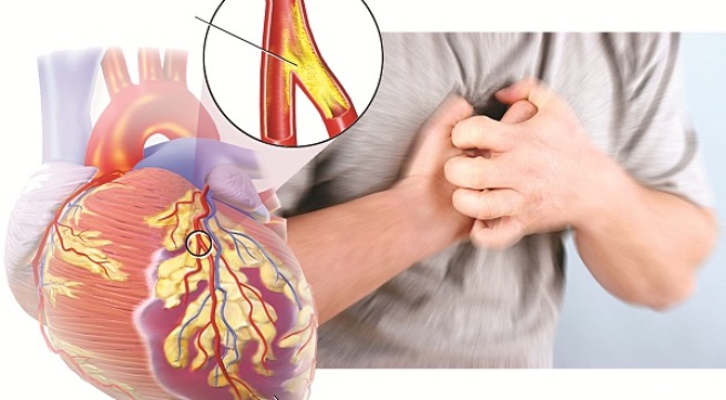 peripheral artery disease pale skin limb pallor circulation poor perfusion