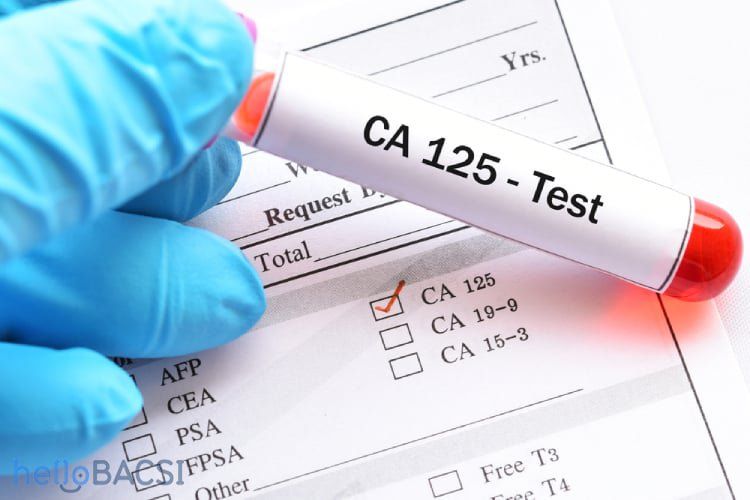 CA-125 test blood draw — serum blood test measuring cancer antigen 125 levels for ovarian cancer monitoring