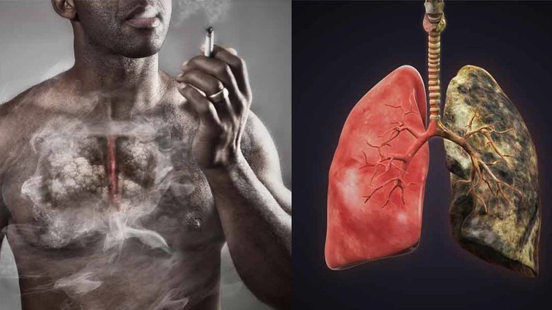 Smoking lung cancer risk tobacco carcinogens pack years cessation LDCT screening DNA mutations