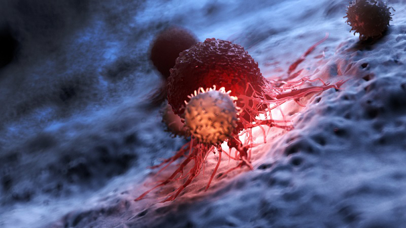 cancer recurrence diagnosis biopsy molecular profiling confirms cancer returned