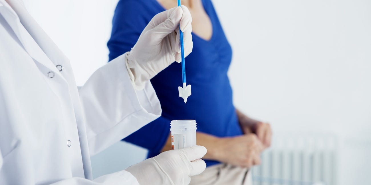 Pap smear cervical cancer screening procedure, a key women's cancer screening test from age 21