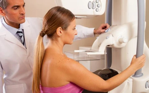 Woman undergoing mammography screening, representing cancer screening recommendations for women