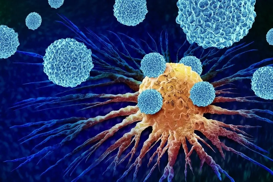 Cancer staging showing Stage IV metastatic cancer cells spreading beyond the primary tumor site