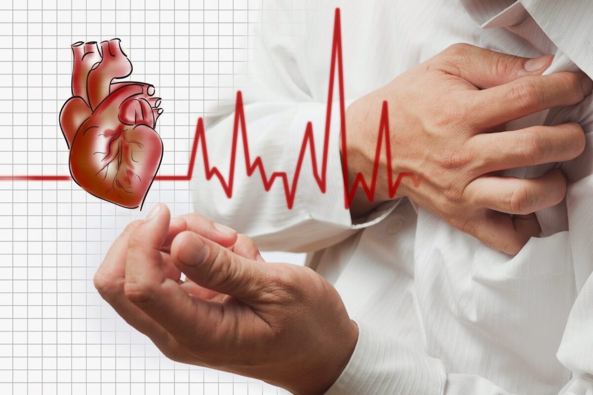 Overview of cardiovascular disease types including coronary artery disease, stroke, and heart failure