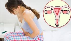 Woman experiencing pelvic pain — a cervical cancer symptom requiring medical evaluation