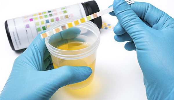 Changes in Urination and Cancer: When Urinary Symptoms Signal Something Serious