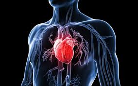 Medical illustration showing the heart and chest area with indicators of chest pain locations associated with different cardiac conditions