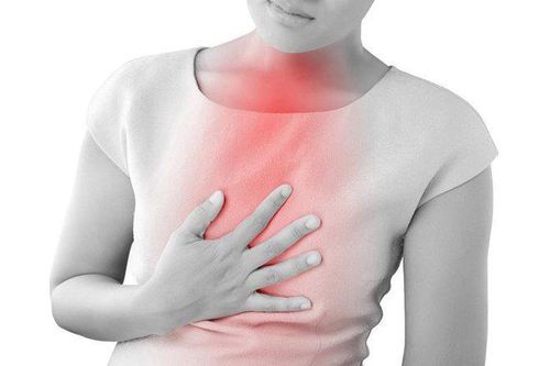 angina chest tightness cardiac evaluation ECG stress test