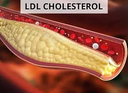 Diagram showing LDL and HDL cholesterol particles in the blood alongside arterial plaque formation