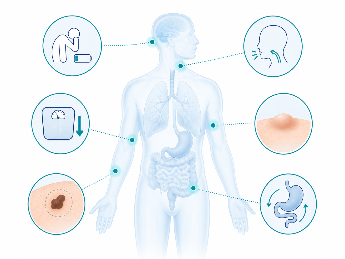 Common early cancer symptoms including fatigue weight loss lumps and skin changes