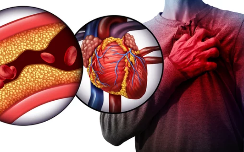 Signs and symptoms of common heart problems in adults shown on anatomical diagram