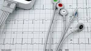cardiac syncope red flags exertional fainting no prodrome versus vasovagal warning signs