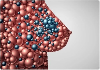 hormone therapy cancer ADT prostate cancer breast cancer treatment