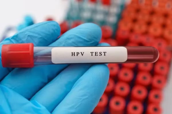 HPV test results interpretation — positive HPV 16/18 versus other high-risk HPV and follow-up pathways