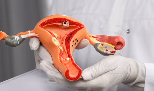 HPV test for cervical cancer screening — comparing HPV testing, Pap smear, and co-testing approaches