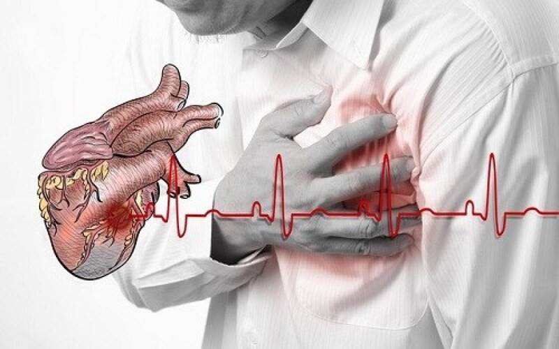 temporomandibular joint TMJ jaw pain cardiac versus dental evaluation