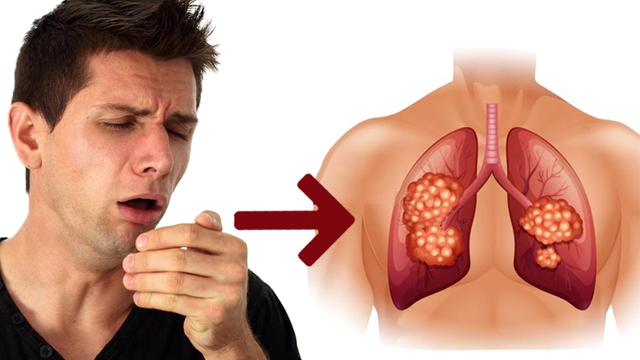lung cancer cough persistent cough warning sign