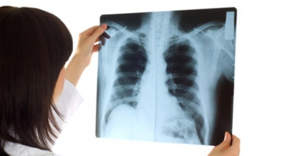 lung cancer screening CT scan pulmonary nodule detection