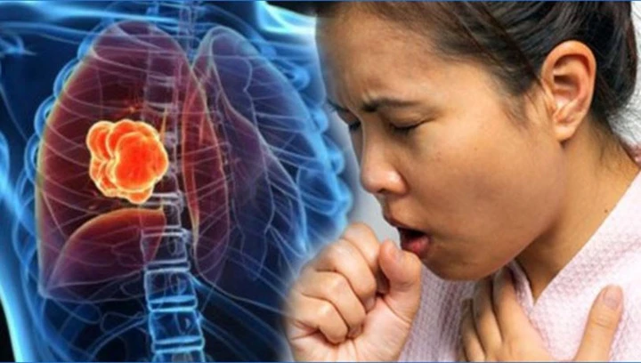lung cancer symptoms cough hemoptysis early warning signs