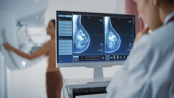 mammogram breast cancer screening X-ray procedure