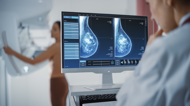 mammogram breast cancer screening X-ray procedure