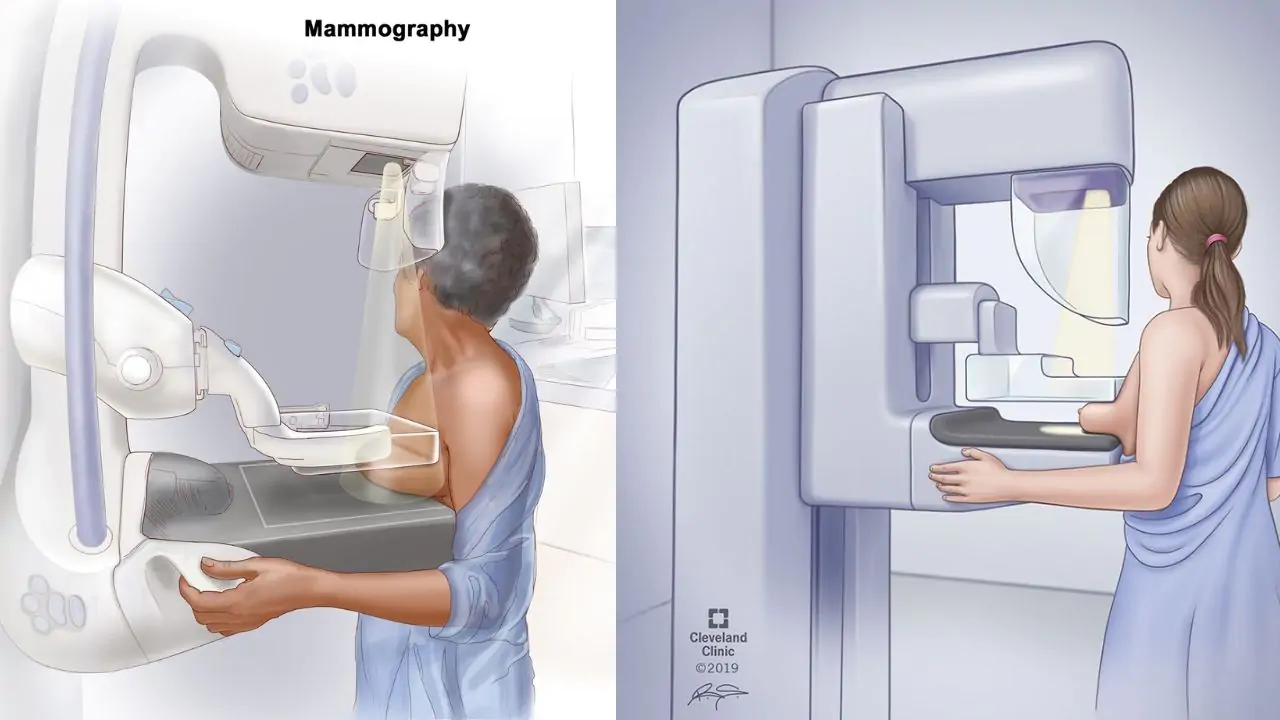 mammogram procedure breast positioning compression