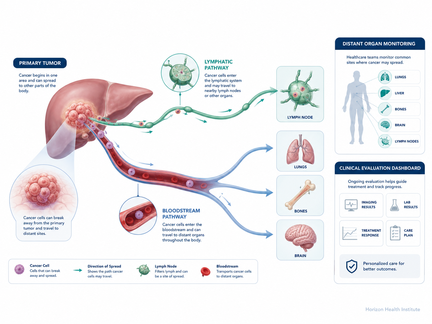 metastatic cancer guide survival rates