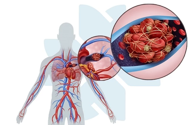 numbness and poor circulation in hands and feet vascular causes