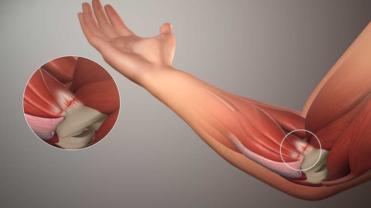 left arm pain assessment cardiac versus musculoskeletal causes