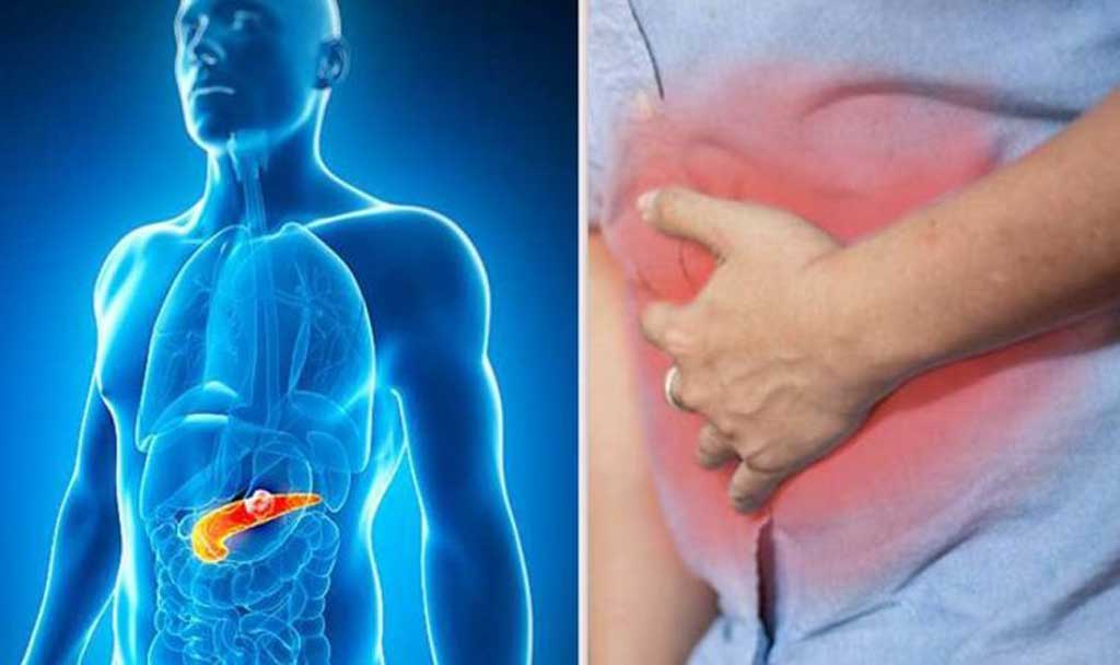 pancreatic cancer head vs body tail symptoms — different symptom patterns based on tumor location in the pancreas
