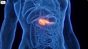pancreatic cancer symptoms — jaundice, abdominal pain, weight loss, and back pain as the key warning signs