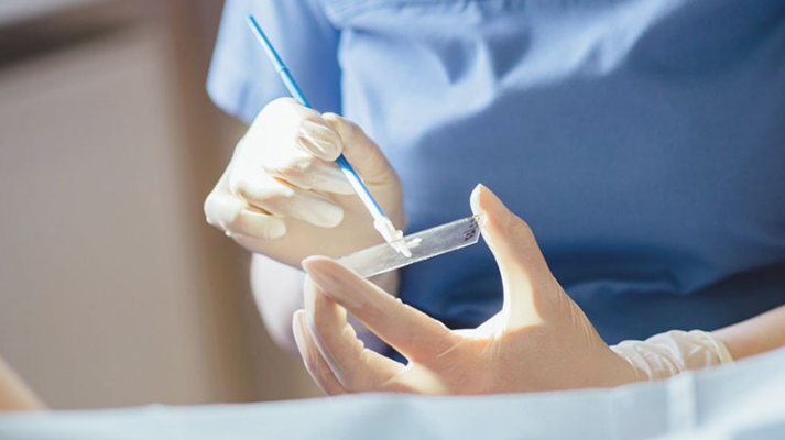 Pap smear procedure — cervical cell collection for cancer screening