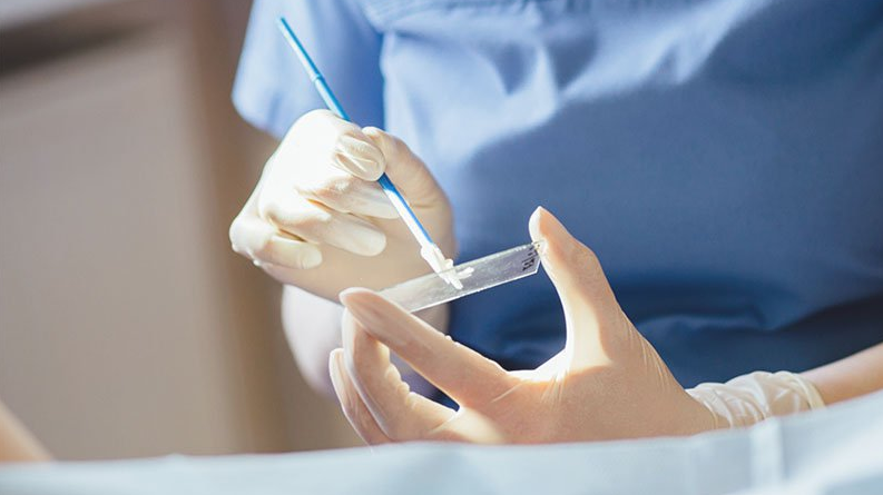 Pap smear procedure — cervical cell collection for cancer screening