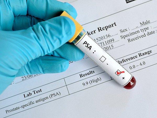prostate cancer symptoms stages and treatment