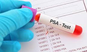 prostate cancer screening PSA test guidelines who should get tested