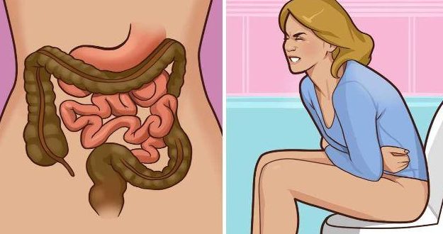 pelvic anatomy illustration showing rectal cancer relationship to surrounding structures