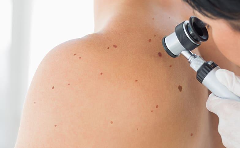 Dermatologist performing professional skin cancer screening examination