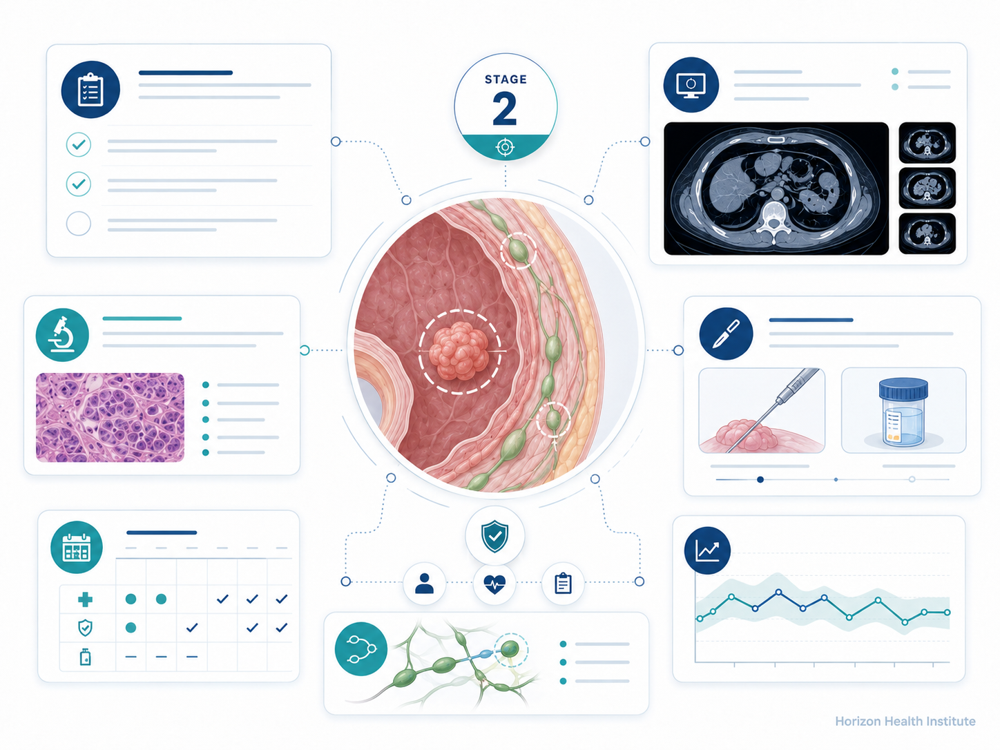 stage 2 cancer guide diagnosis