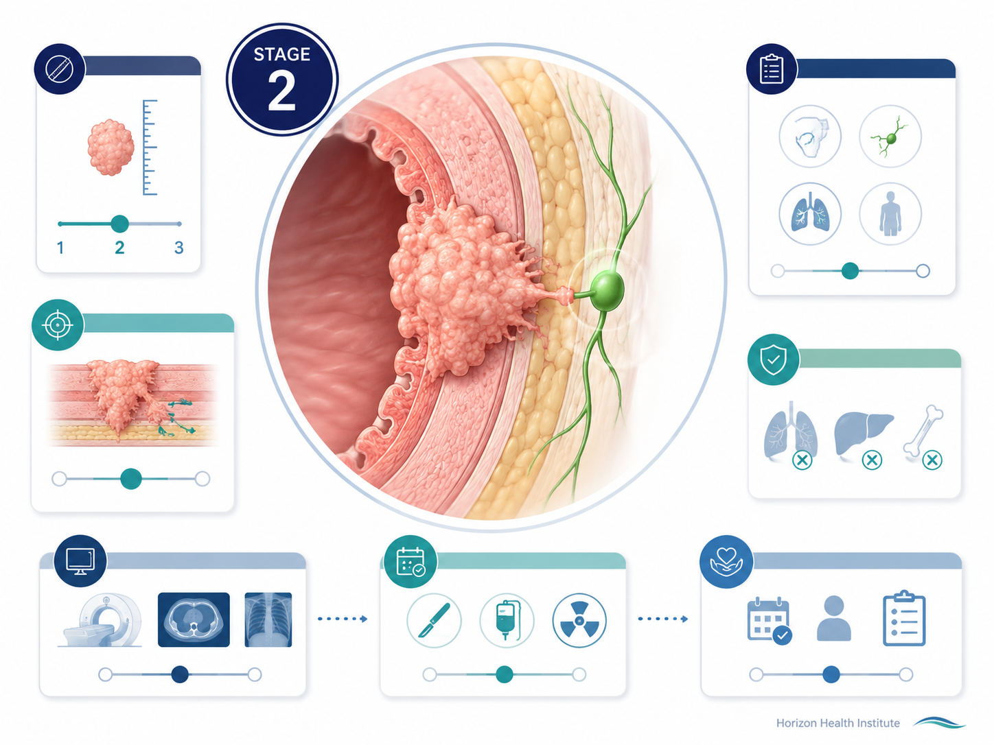 stage 2 cancer guide survival rates