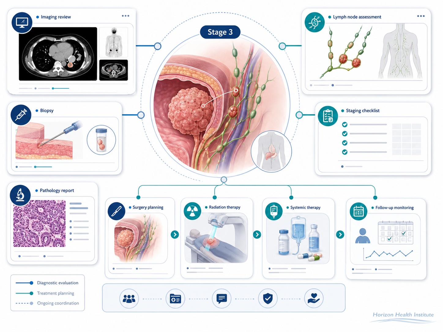 stage 3 cancer guide diagnosis