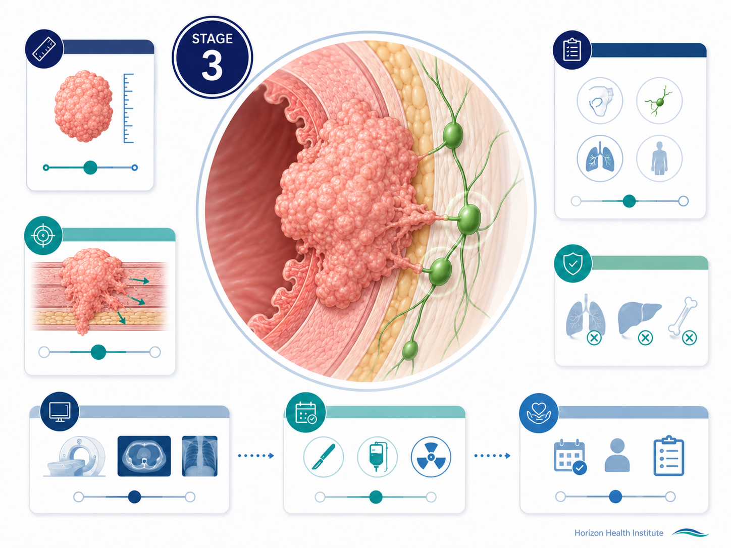 stage 3 cancer guide survival rates
