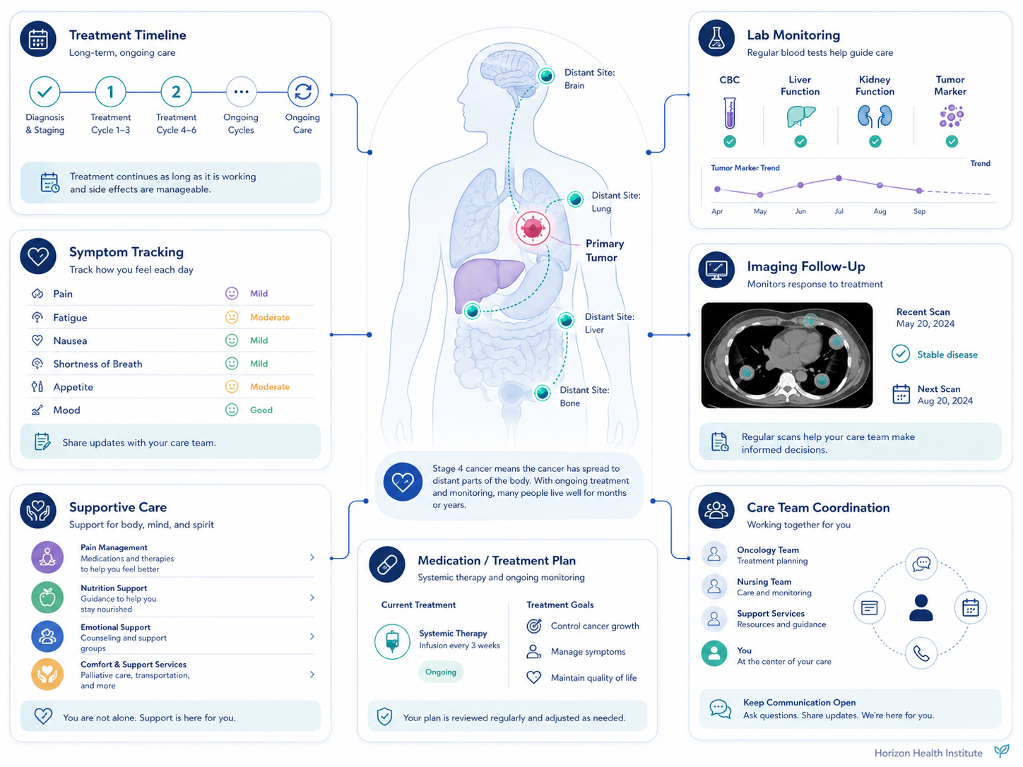 stage 4 cancer guide treatment