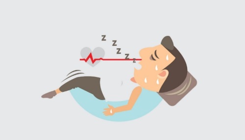 paroxysmal nocturnal dyspnea PND versus orthopnea heart failure supine sleeping