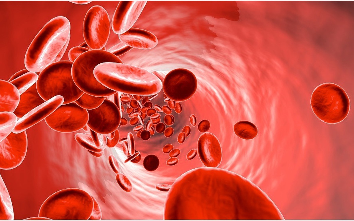 Unexplained anemia cancer iron deficiency bone marrow leukoerythroblastic warning signs blood smear