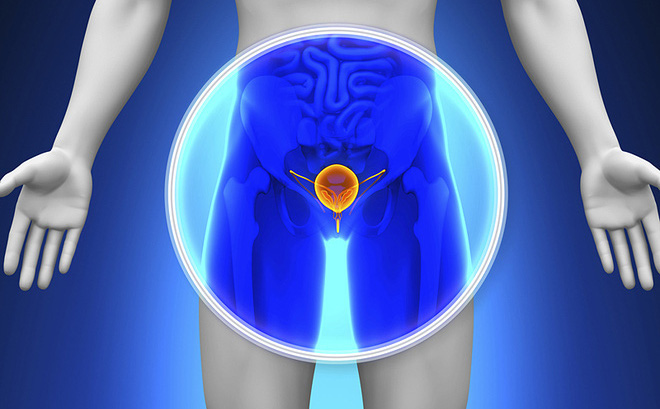urinary symptoms prostate cancer — man discussing urinary changes with urologist