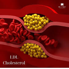 Medical illustration showing cholesterol molecules and lipoproteins in the bloodstream relevant to heart health