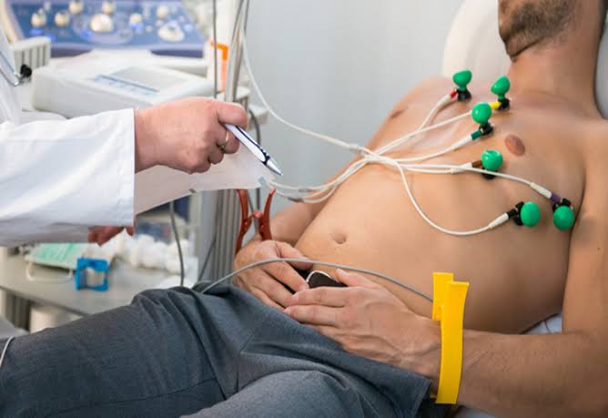 ECG interpretation atrial fibrillation STEMI ST elevation bundle branch block QT prolongation arrhythmia findings