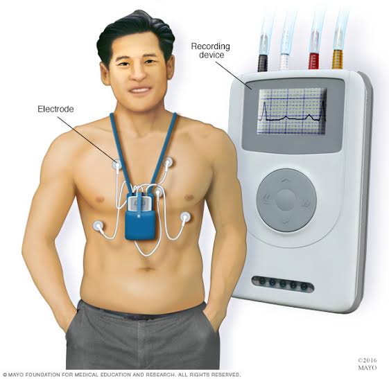 Holter monitor tracking heart rhythm 24-hour ECG continuous ambulatory arrhythmia detection palpitations atrial fibrillation