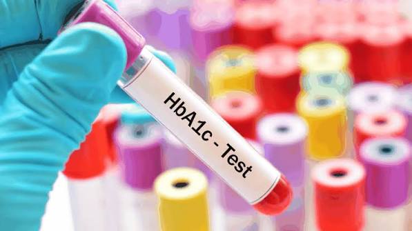 A1C test showing hemoglobin glycation as a measure of average blood sugar over 2 to 3 months for diabetes screening